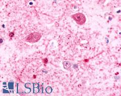 ADGRB2 / BAI2 Antibody - Brain, Amygdala, neurons and glia