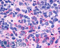 ADGRB3 / BAI3 Antibody - Brain, Glioblastoma