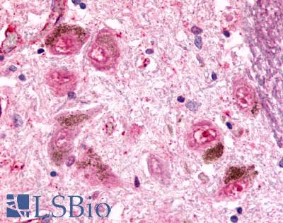 ADGRE2 / EMR2 Antibody - Brain, Substantia nigra, pigmented neurons