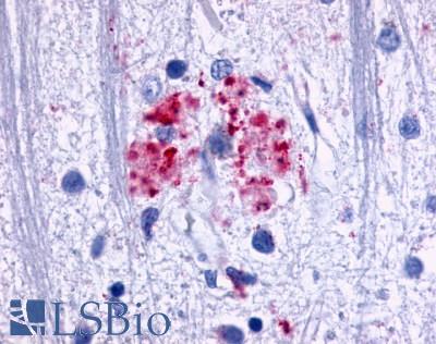 ADGRE3 / EMR3 Antibody - Brain, Alzheimer's, senile plaque