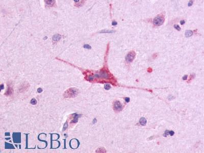 ADGRE5 / CD97 Antibody - Brain Caudate Neuron and Glia