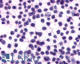 ADGRE5 / CD97 Antibody - Anti-CD97 antibody immunocytochemistry (ICC) staining of untransfected HEK293 human embryonic kidney cells.