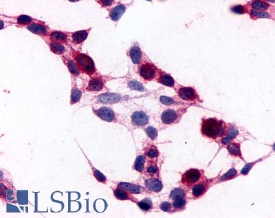 ADGRE5 / CD97 Antibody - Anti-CD97 antibody immunocytochemistry (ICC) staining of HEK293 human embryonic kidney cells transfected with CD97.