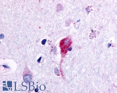 ADGRF4 / GPR115 Antibody - Brain, Amygdala