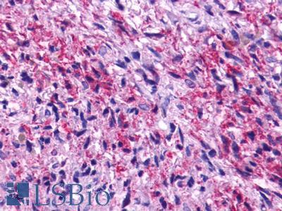 ADGRG1 / GPR56 Antibody - Brain, Glioblastoma
