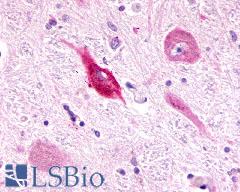 ADGRL3 / LPHN3 Antibody - Brain, Medulla