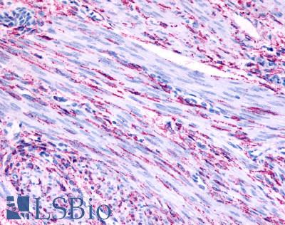 ADRA1B / Adrenoceptor alpha 1B Antibody - Uterus, smooth muscle