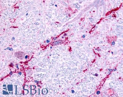 ADRA1B Antibody - Brain Medulla Nerve Fibers