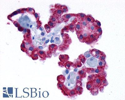 ADRA1D / Adrenoceptor alpha 1D Antibody - Brain Thalamus Adjacent Choroid Plexus Epithelium