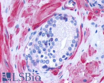 ADRA1D / Adrenoceptor alpha 1D Antibody - Anti-ADRA1D antibody IHC of human prostate. Immunohistochemistry of formalin-fixed, paraffin-embedded tissue after heat-induced antigen retrieval.