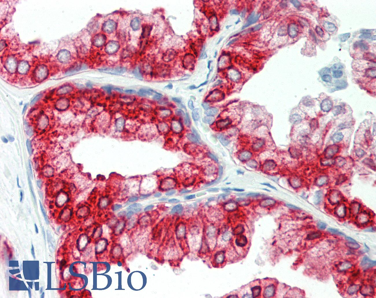 AGR2 Antibody - Human Prostate: Formalin-Fixed, Paraffin-Embedded (FFPE)