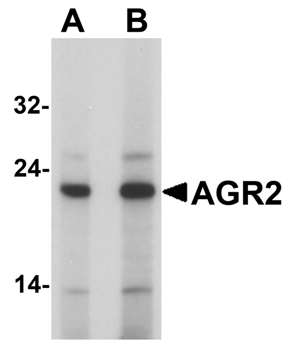 AGR2 Antibody - Western blot analysis of AGR2 in HeLa cell lysate with AGR2 antibody at (A) 1 and (B) 2 ug/ml