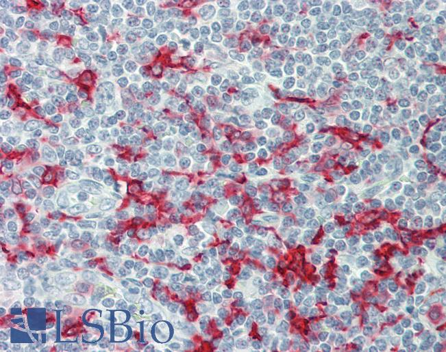 AIF1 / IBA1 Antibody - Human Tonsil: Formalin-Fixed, Paraffin-Embedded (FFPE).  This image was taken for the unconjugated form of this product. Other forms have not been tested.