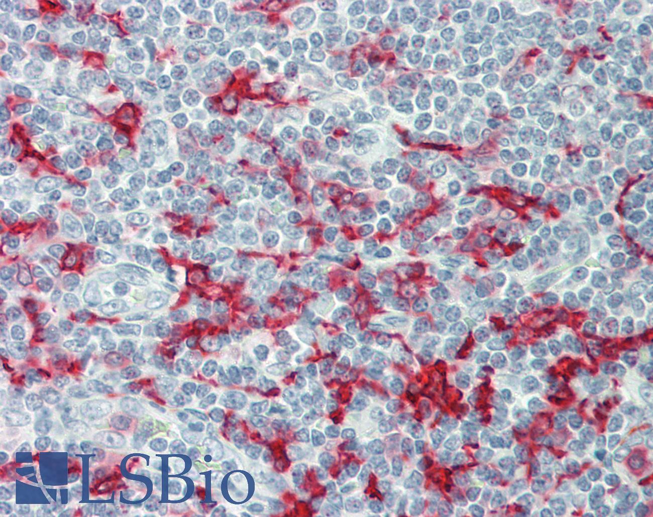 AIF1 / IBA1 Antibody - Human Tonsil: Formalin-Fixed, Paraffin-Embedded (FFPE).  This image was taken for the unconjugated form of this product. Other forms have not been tested.