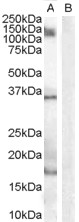 AIF1 / IBA1 Antibody - Antibody (1 ug/ml) staining of Human Peripheral Blood Mononucleocyte lysate (35 ug protein in RIPA buffer) with (B) and without (A) blocking with the immunizing peptide. Primary incubation was 1 hour. Detected by chemiluminescence.