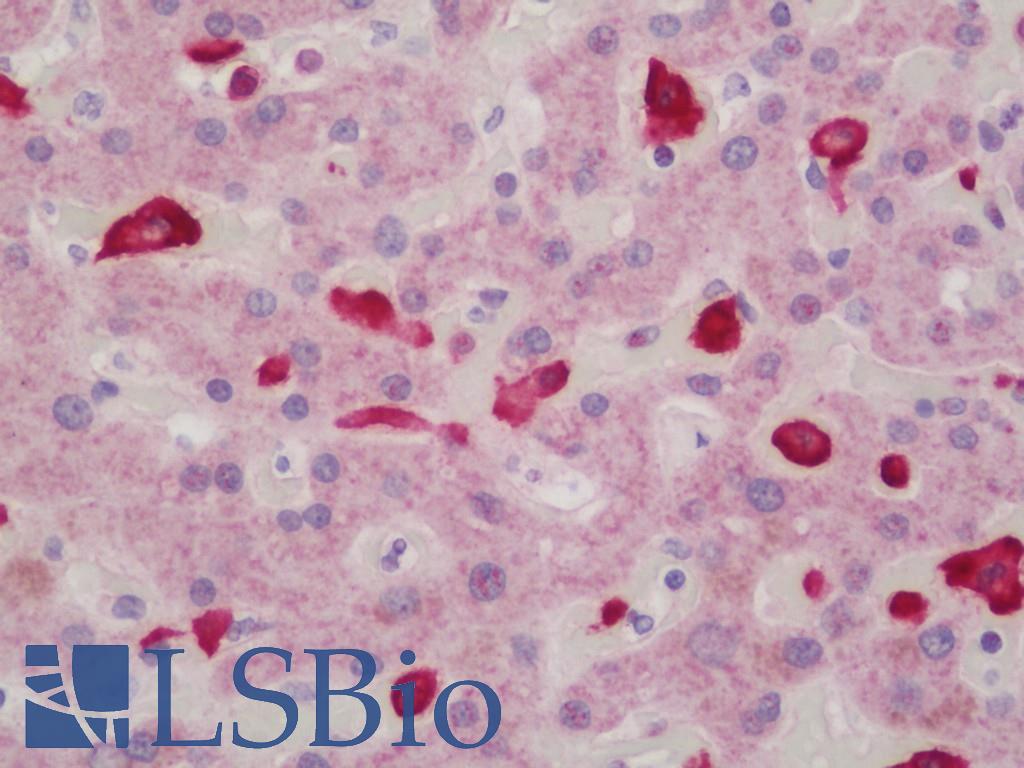 AIF1 / IBA1 Antibody - Anti-AIF1 / IBA1 antibody IHC staining of human liver. Immunohistochemistry of formalin-fixed, paraffin-embedded tissue after heat-induced antigen retrieval.