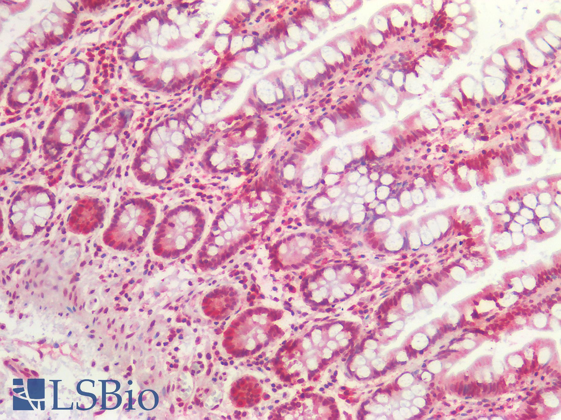 AKT1 Antibody - Human Small Intestine: Formalin-Fixed, Paraffin-Embedded (FFPE)