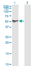 ALDH1A1 / ALDH1 Antibody - Western blot of ALDH1A1 expression in transfected 293T cell line. Lane 1: ALDH1A1 transfected lysate (Predicted MW: 54.9 KDa). Lane 2: Non-transfected lysate.