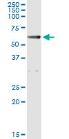 ALDH1A1 / ALDH1 Antibody - Immunoprecipitation of ALDH1A1 transfected lysate using anti-ALDH1A1 monoclonal antibody and Protein A Magnetic Bead.