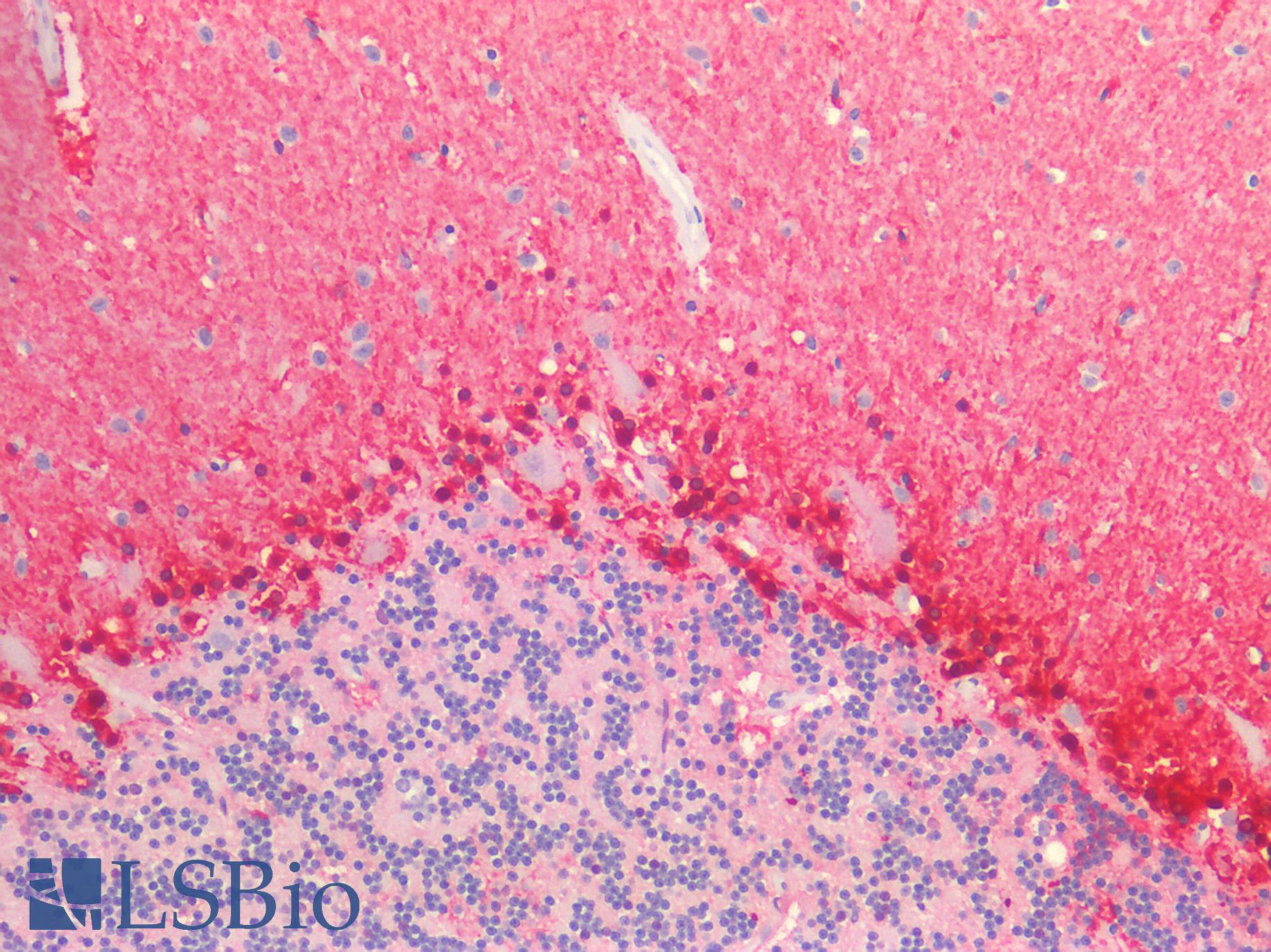 ALDH1A1 / ALDH1 Antibody - Human Brain, Cerebellum: Formalin-Fixed, Paraffin-Embedded (FFPE)
