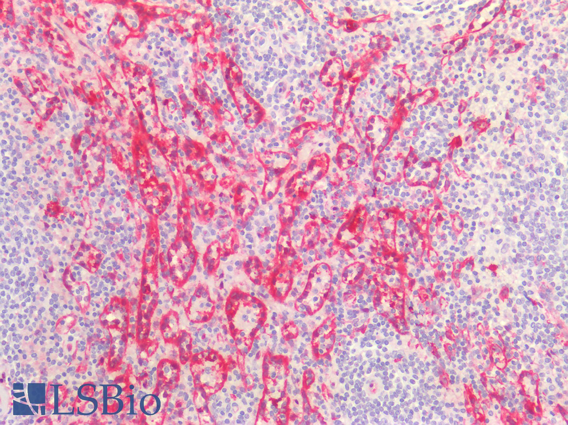 ALDH1A1 / ALDH1 Antibody - Human Spleen: Formalin-Fixed, Paraffin-Embedded (FFPE)