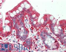 ALDH1A1 / ALDH1 Antibody - Anti-ALDH1A1 / ALDH1 antibody IHC staining of human small intestine. Immunohistochemistry of formalin-fixed, paraffin-embedded tissue after heat-induced antigen retrieval. Antibody dilution 1:50.