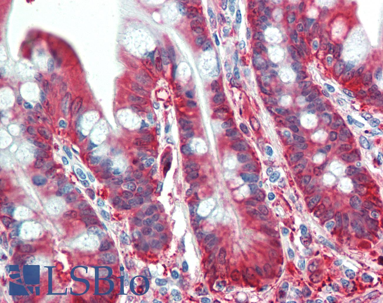 ALDH1A1 / ALDH1 Antibody - Anti-ALDH1A1 / ALDH1 antibody IHC staining of human small intestine. Immunohistochemistry of formalin-fixed, paraffin-embedded tissue after heat-induced antigen retrieval.