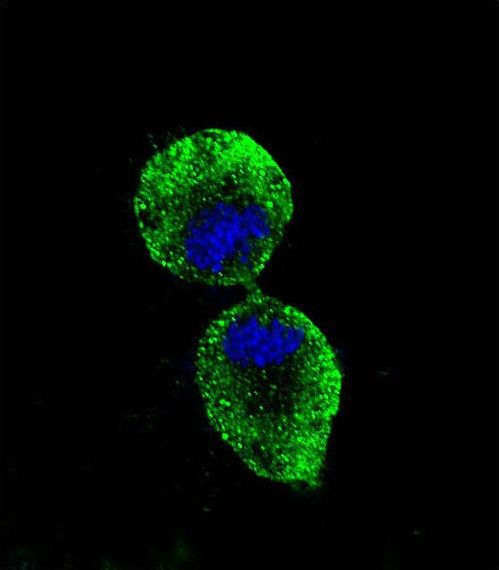 ALDH1A1 / ALDH1 Antibody - Confocal immunofluorescence of ALDH1A1 Antibody with NCI-H460 cell followed by Alexa Fluor 488-conjugated goat anti-mouse lgG (green). DAPI was used to stain the cell nuclear (blue).