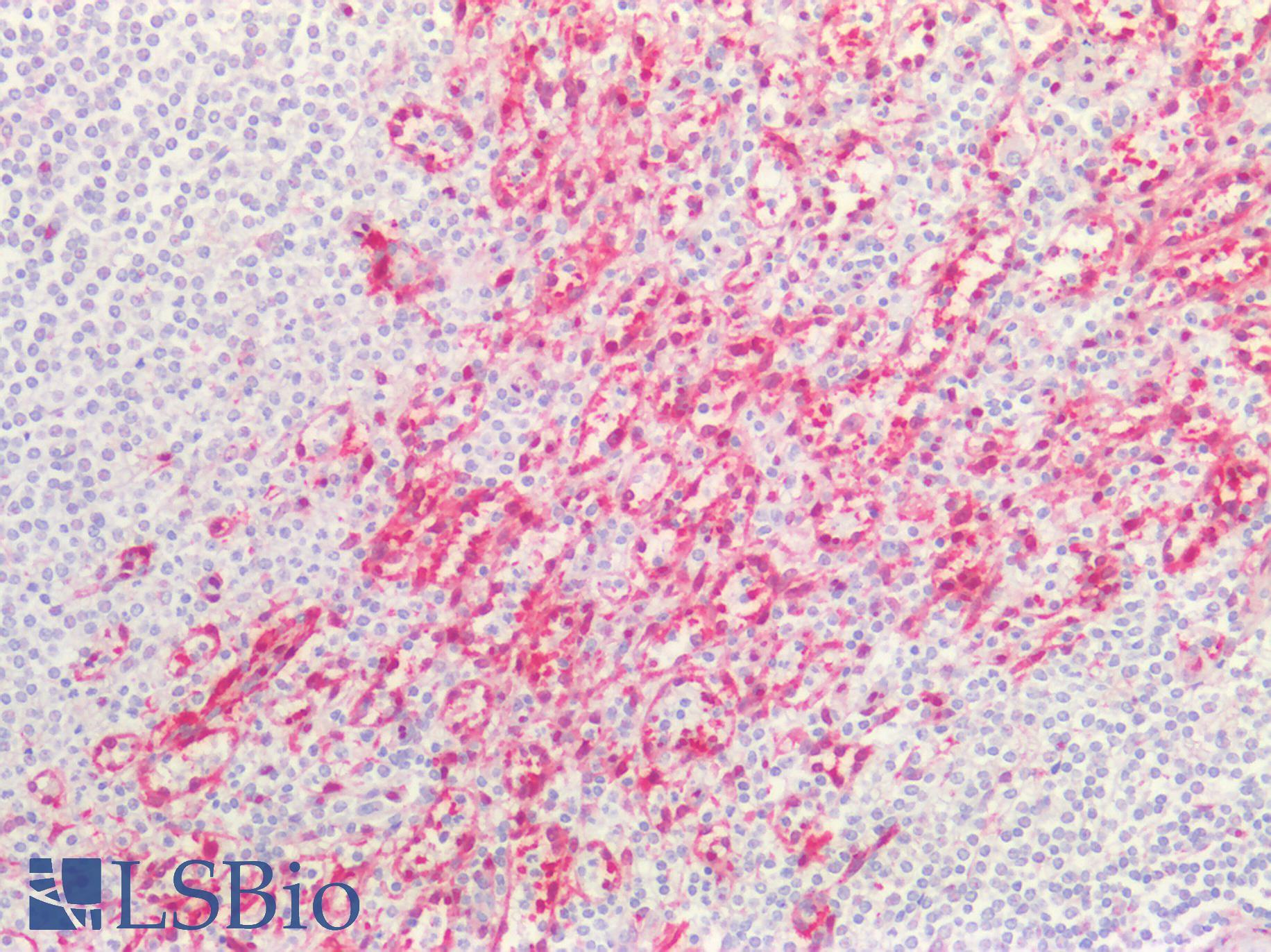 ALDH1A1 / ALDH1 Antibody - Human Spleen: Formalin-Fixed, Paraffin-Embedded (FFPE)