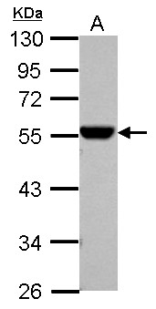 ALDH1A1 / ALDH1 Antibody - Sample (30 ug of whole cell lysate) A: A549 10% SDS PAGE ALDH1A1 antibody diluted at 1:10000