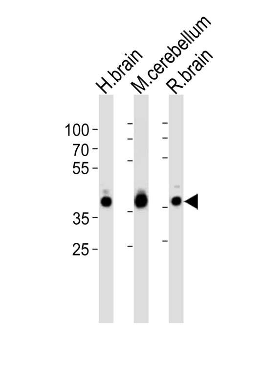 ALDOC / Aldolase C Antibody - Western blot of lysates from human brain, mouse cerebellum and rat brain tissue lysate (from left to right), using ALDOC Antibody. Antibody was diluted at 1:1000 at each lane. A goat anti-rabbit IgG H&L (HRP) at 1:10000 dilution was used as the secondary antibody. Lysates at 35ug per lane.