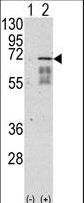 ALK2 / ACVR1 Antibody - Western blot of ACVR1 (arrow) using rabbit polyclonal ACVR1 Antibody (Center N153). 293 cell lysates (2 ug/lane) either nontransfected (Lane 1) or transiently transfected with the ACVR1 gene (Lane 2) (Origene Technologies).