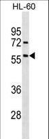 ALK2 / ACVR1 Antibody - ACVR1 Antibody western blot of HL-60 cell line lysates (35 ug/lane). The ACVR1 antibody detected the ACVR1 protein (arrow).