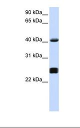 Alpha-1-Antichymotrypsin Antibody - 721_B cell lysate. Antibody concentration: 1.0 ug/ml. Gel concentration: 12%.  This image was taken for the unconjugated form of this product. Other forms have not been tested.