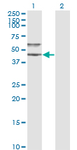 Alpha-1-Antichymotrypsin Antibody - Western blot of SERPINA3 expression in transfected 293T cell line by SERPINA3 monoclonal antibody (M01), clone 1E6.