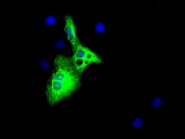 Alpha-Fetoprotein Antibody - Anti-AFP mouse monoclonal antibody  immunofluorescent staining of COS7 cells transiently transfected by pCMV6-ENTRY AFP.