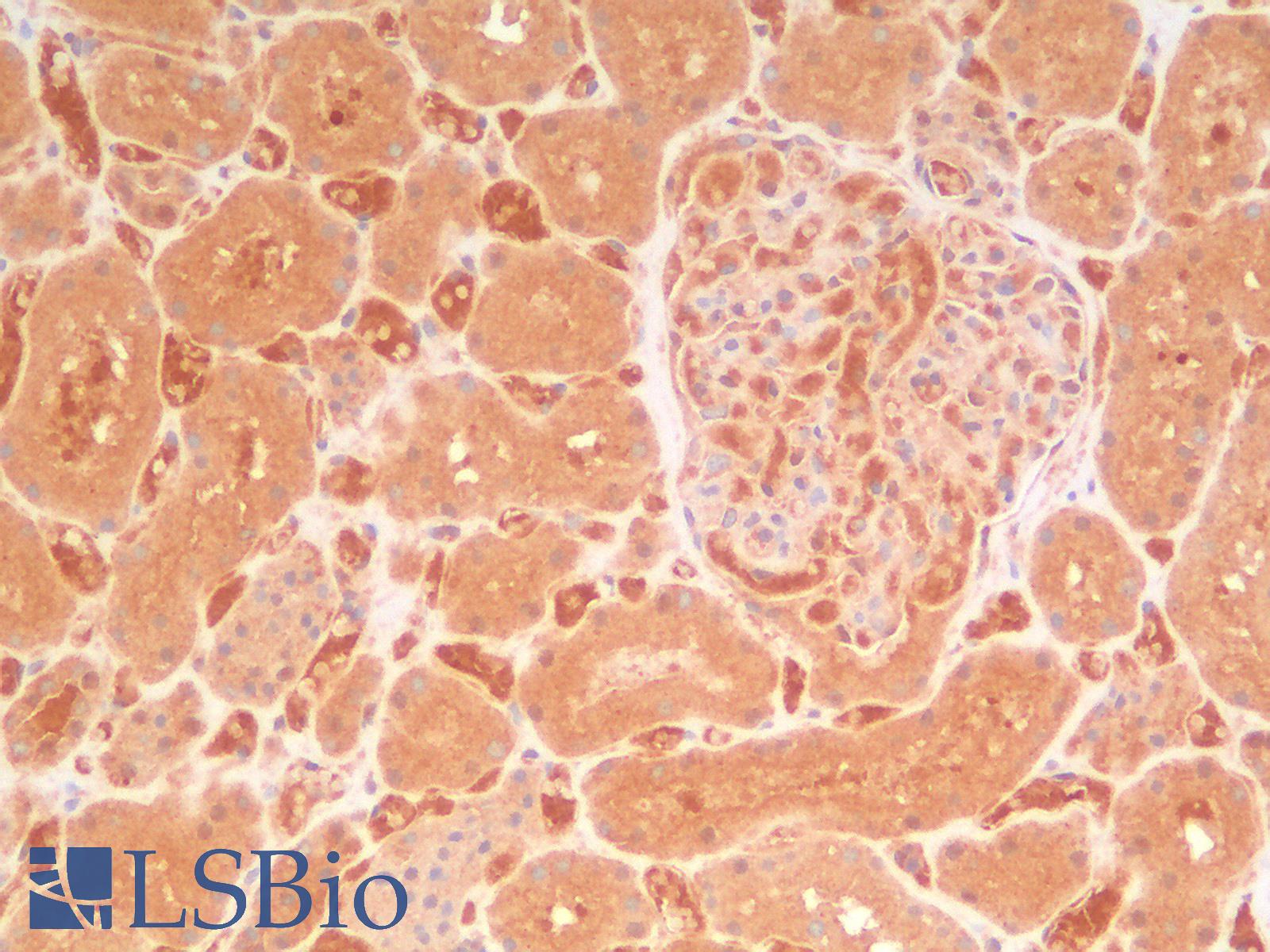 AMACR / P504S Antibody - Human Kidney: Formalin-Fixed, Paraffin-Embedded (FFPE)