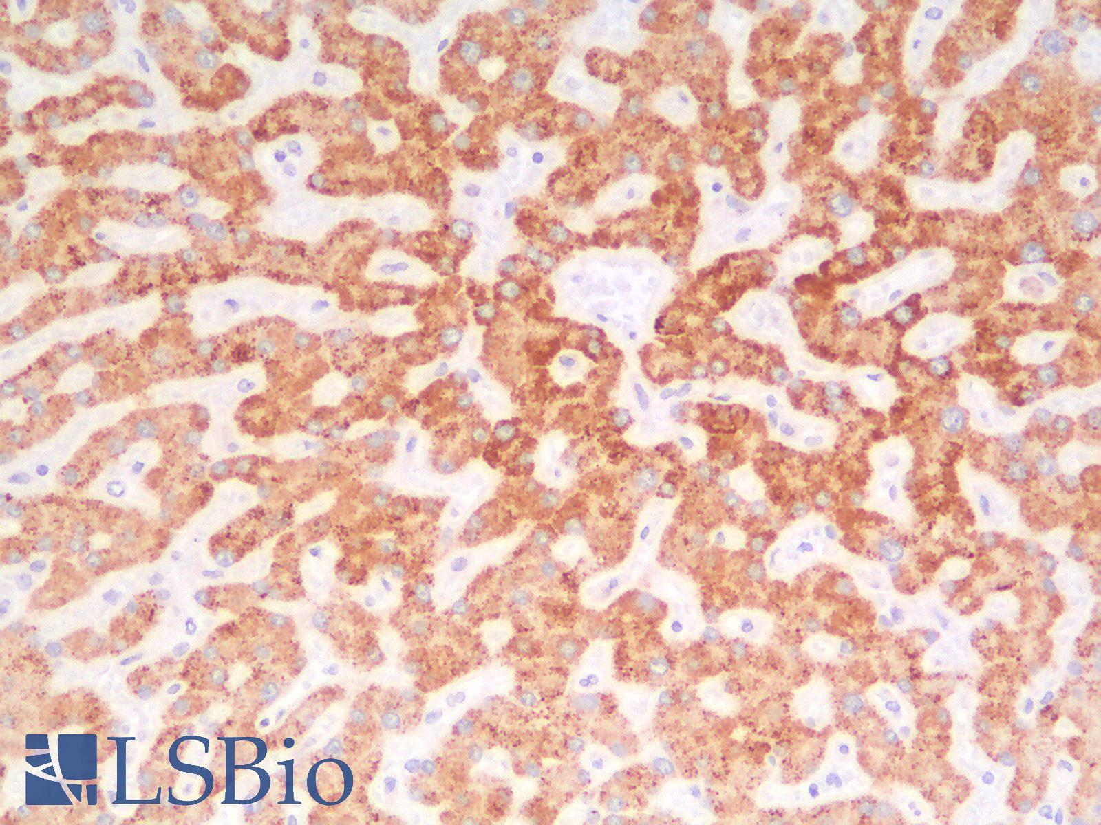 AMACR / P504S Antibody - Human Liver: Formalin-Fixed, Paraffin-Embedded (FFPE)