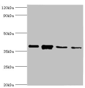 ANXA1 / Annexin A1 Antibody - Western blot All lanes: Anxa1 antibody at 2µg/ml Lane 1: PC-3 whole cell lysate Lane 2: A431 whole cell lysate Lane 3: K562 whole cell lysate Lane 4: MCF-7 whole cell lysate Secondary Goat polyclonal to rabbit IgG at 1/10000 dilution Predicted band size: 39 kDa Observed band size: 39 kDa