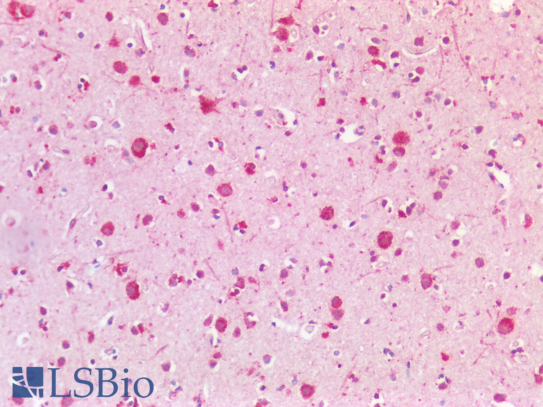 APBA3 / MINT3 Antibody - Human Brain, Cortex: Formalin-Fixed, Paraffin-Embedded (FFPE)