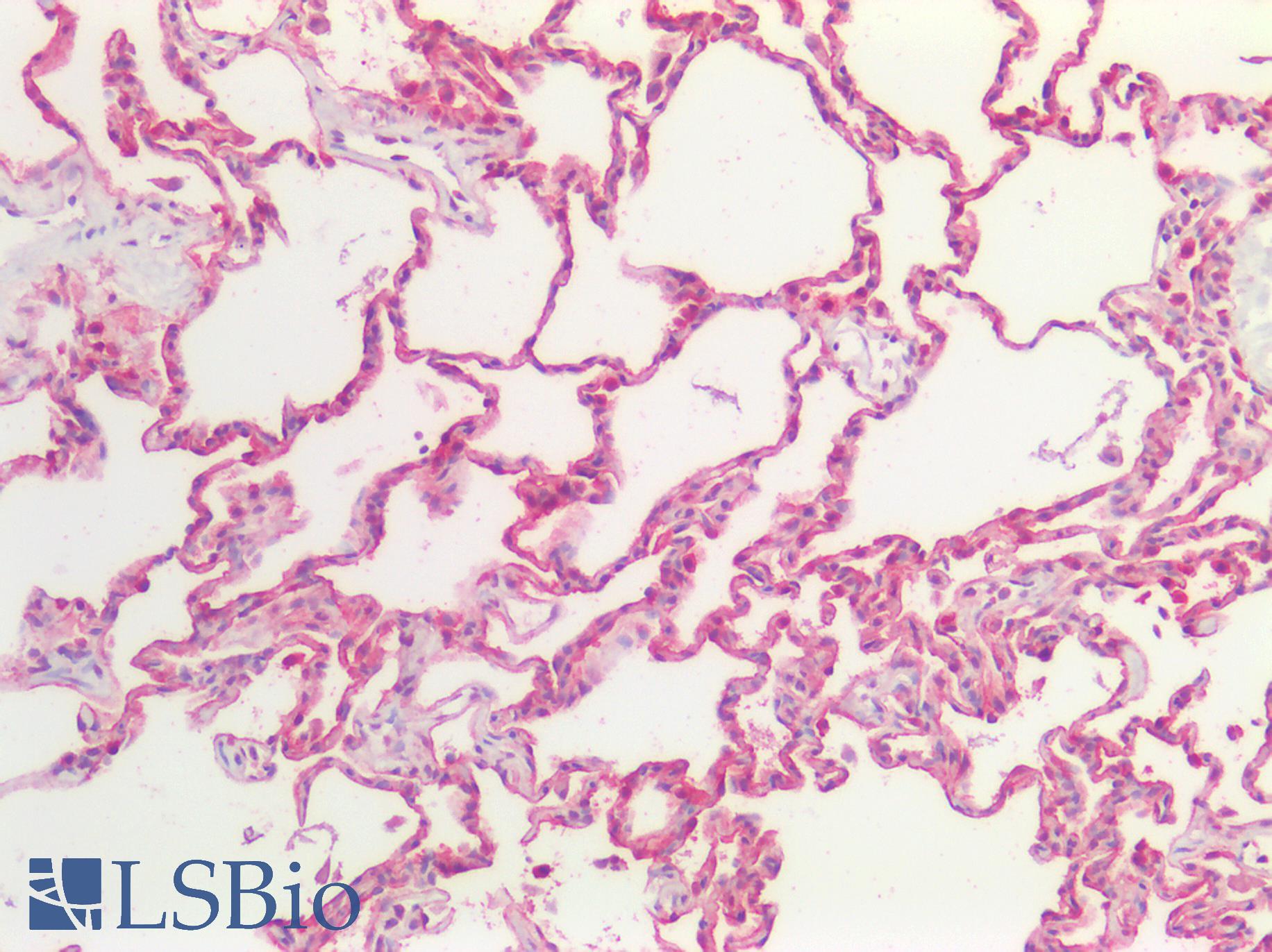 APC Antibody - Human Lung: Formalin-Fixed, Paraffin-Embedded (FFPE)