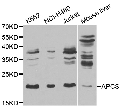 APCS / Serum Amyloid P / SAP Antibody - Western blot analysis of extracts of various cell lines, using APCS antibody.