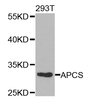 APCS / Serum Amyloid P / SAP Antibody - Western blot analysis of extracts of 293T cells.