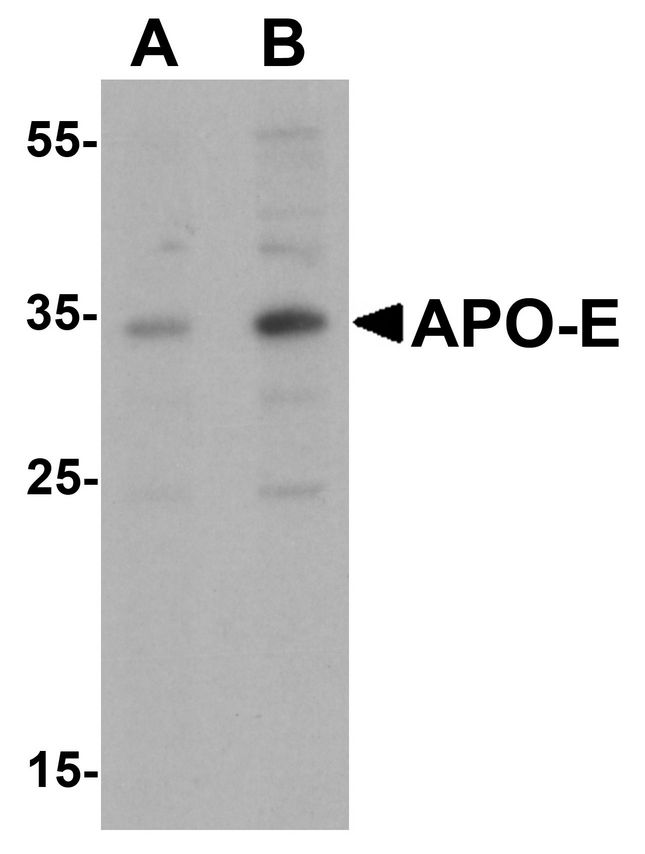 APOE / Apolipoprotein E Antibody - Western blot analysis of APO-E in human brain tissue lysate with APO-E antibody at (A) 0.5 and (B) 1 ug/ml.