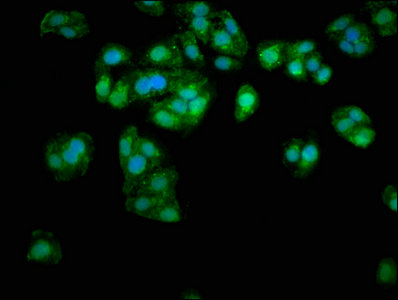 APOE / Apolipoprotein E Antibody - Immunofluorescence staining of HepG2 cells with APOE Antibody at 1:333, counter-stained with DAPI. The cells were fixed in 4% formaldehyde, permeabilized using 0.2% Triton X-100 and blocked in 10% normal Goat Serum. The cells were then incubated with the antibody overnight at 4°C. The secondary antibody was Alexa Fluor 488-congugated AffiniPure Goat Anti-Rabbit IgG(H+L).