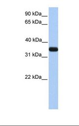 APOE / Apolipoprotein E Antibody - Fetal liver lysate. Antibody concentration: 1.0 ug/ml. Gel concentration: 12%.  This image was taken for the unconjugated form of this product. Other forms have not been tested.