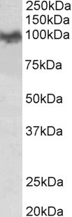 APP / Beta Amyloid Precursor Antibody - APP / Beta Amyloid Precursor antibody (0.03µg/ml) staining of Mouse Brain lysate (35µg protein in RIPA buffer). Detected by chemiluminescence.