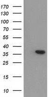 ARG1 / Arginase 1 Antibody - HEK293T cells were transfected with the pCMV6-ENTRY control (Left lane) or pCMV6-ENTRY ARG1 (Right lane) cDNA for 48 hrs and lysed. Equivalent amounts of cell lysates (5 ug per lane) were separated by SDS-PAGE and immunoblotted with anti-ARG1.