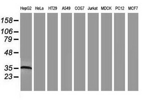ARG1 / Arginase 1 Antibody - Western blot of extracts (35ug) from 9 different cell lines by using anti-ARG1 monoclonal antibody.
