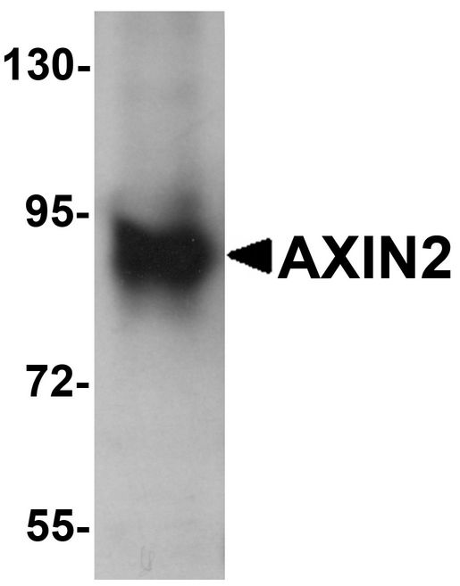 AXIN2 / Axin 2 Antibody - Western blot analysis of AXIN2 in mouse lung lysate with AXIN2 antibody at 1 ug/ml.